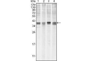 Western blot analysis using MCL1 mouse mAb against Hela (1), BCBL-1 (2), Jurkat (3) and HL60 (4) cell lysate. (MCL-1 antibody)