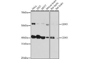 Western blot analysis of extracts of various cell lines, using CDK9 Rabbit mAb (ABIN7266597) at 1:1000 dilution. (CDK9 antibody)