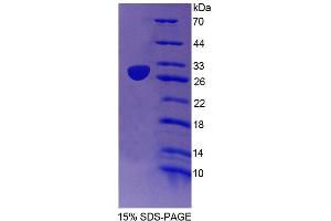 SDS-PAGE analysis of Mouse EMILIN2 Protein. (EMILIN2 Protein)