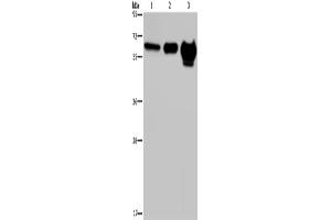 Western Blotting (WB) image for anti-Matrix Metalloproteinase 20 (MMP20) antibody (ABIN2435010) (MMP20 antibody)