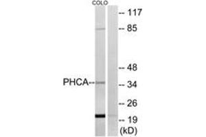 Western blot analysis of extracts from COLO cells, using PHCA Antibody.