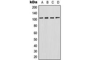 Western blot analysis of HIPK2 expression in HepG2 (A), MCF7 (B), SP2/0 (C), PC12 (D) whole cell lysates. (HIPK2 antibody  (C-Term))