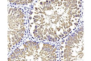 Immunohistochemistry analysis of paraffin-embedded rat testis using GLUT-3 Polyclonal Antibody at dilution of 1:400. (SLC2A3 antibody)