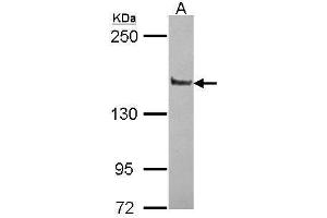 WB Image Sample (30 ug of whole cell lysate) A: JurKat 5% SDS PAGE antibody diluted at 1:10000