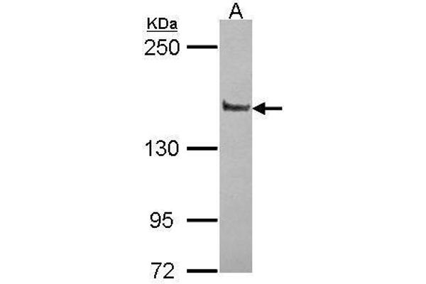 PPFIA1 antibody  (N-Term)