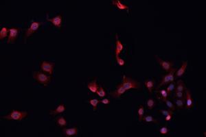 ABIN6268934 staining MCF-7 cells by IF/ICC.