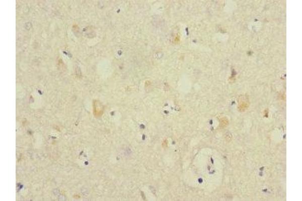ANKS1B antibody  (AA 999-1248)