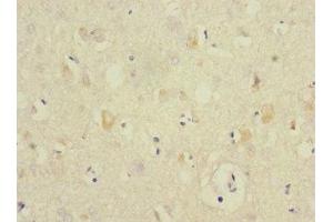 Immunohistochemistry of paraffin-embedded human brain tissue using ABIN7144207 at dilution of 1:100 (ANKS1B antibody  (AA 999-1248))