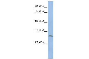 WB Suggested Anti-ELA1 Antibody Titration: 0. (CELA1 antibody  (N-Term))