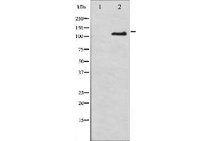 Western Blotting (WB) image for anti-Integrin beta 3 (ITGB3) (pTyr785) antibody (ABIN6256804)