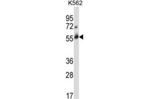 Western Blotting (WB) image for anti-Cbl proto-oncogene C (CBLC) antibody (ABIN2996838) (CBLC antibody)