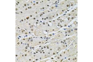 Immunohistochemistry of paraffin-embedded human stomach using H2AFZ antibody (ABIN5973977) at dilution of 1/100 (40x lens). (H2AFZ antibody)
