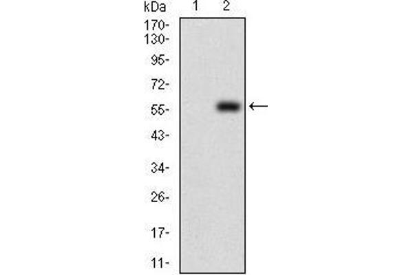 PDK2 Antikörper  (AA 178-404)