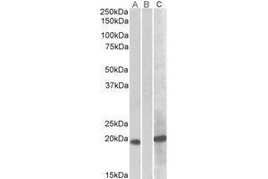 Western Blotting (WB) image for anti-Homeobox A1 (HOXA1) (Internal Region) antibody (ABIN2464864)
