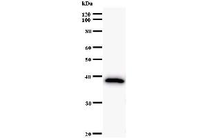 Western Blotting (WB) image for anti-AT Rich Interactive Domain 2 (ARID, RFX-Like) (ARID2) antibody (ABIN933106) (ARID2 antibody)