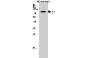 Western Blotting (WB) image for anti-Epsin 1 (EPN1) (Internal Region) antibody (ABIN3174995) (Epsin 1 antibody  (Internal Region))