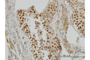 Immunoperoxidase of monoclonal antibody to TOP2A on formalin-fixed paraffin-embedded human testis. (Topoisomerase II alpha antibody  (AA 1435-1531))