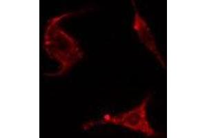 ABIN6278285 staining HepG2 cells by IF/ICC. (ENAH antibody  (Internal Region))