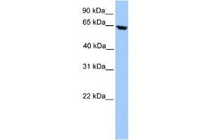 ACADVL antibody used at 1 ug/ml to detect target protein. (ACADVL antibody  (N-Term))