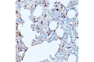 Immunohistochemistry of paraffin-embedded rat lung using CXCR1 antibody (ABIN7266317) at dilution of 1:100 (40x lens). (CXCR1 antibody  (AA 250-350))