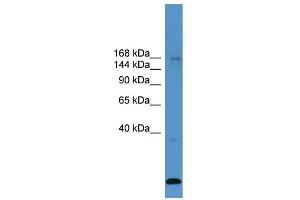 WB Suggested Anti-USP47  Antibody Titration: 0. (USP47 antibody  (Middle Region))