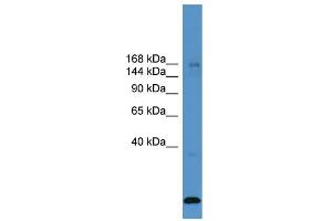 WB Suggested Anti-USP47  Antibody Titration: 0.