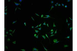 Immunofluorescence staining of SH-SY5Y cells with ABIN7168240-IF at 1:100, counter-stained with DAPI. (RNF122 antibody  (AA 65-145))