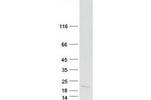 Western Blotting (WB) image for Dolichyl-Phosphate Mannosyltransferase Polypeptide 3 (DPM3) (Transcript Variant 1) protein (Myc-DYKDDDDK Tag) (ABIN2719702)