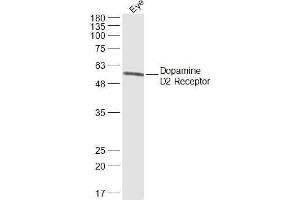 Mouse eye lysates probed with Dopamine D2 Receptor Polyclonal Antibody, Unconjugated  at 1:300 dilution and 4˚C overnight incubation. (Dopamine d2 Receptor antibody  (AA 301-400))