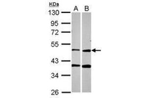 Image no. 1 for anti-Protoporphyrinogen Oxidase (PPOX) (AA 179-418) antibody (ABIN1500380)