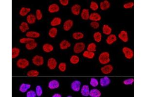 Confocal immunofluorescence analysis of HeLa cells using Histone H2AX Polyclonal Antibody at dilution of 1:400.