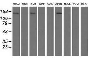 Western blot analysis of extracts (35 µg) from 9 different cell lines by using anti-HDAC6 monoclonal antibody. (HDAC6 antibody)