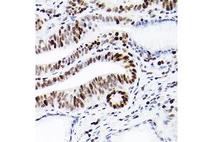 Immunohistochemistry of paraffin-embedded human colon carcinoma using MCM2 Rabbit mAb (ABIN7268538) at dilution of 1:100 (40x lens). (MCM2 antibody)