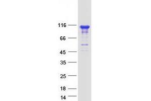 Validation with Western Blot (INPP4B Protein (Transcript Variant 1) (Myc-DYKDDDDK Tag))