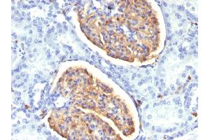 Formalin-fixed, paraffin-embedded human Kidney stained with AIF1 / Iba1 Mouse Monoclonal Antibody (AIF1/1909).