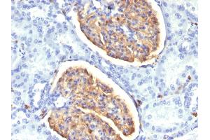 Formalin-fixed, paraffin-embedded human Kidney stained with AIF1 / Iba1 Mouse Monoclonal Antibody (AIF1/1909). (Iba1 antibody  (AA 1-146))