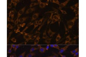 Immunofluorescence analysis of C6 cells using EIF5B Polyclonal Antibody at dilution of 1:100. (EIF5B antibody)