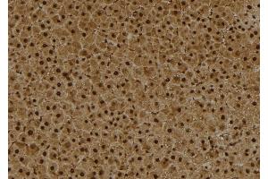 ABIN6260236 and ABIN6273993 at 1/100 staining Rat liver tissue by IHC-P. (BCL6 antibody  (Internal Region))