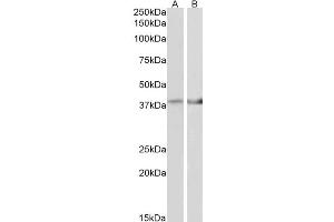 ABIN768560 (2µg/ml) staining of Mouse Heart (A) and Mouse Muscle (B) lysate (35µg protein in RIPA buffer). (IDH3B antibody  (AA 33-46))