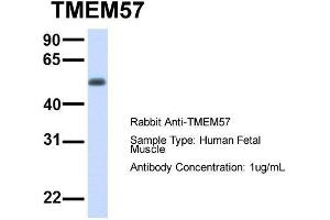 Host:  Rabbit  Target Name:  TMEM57  Sample Type:  Human Fetal Muscle  Antibody Dilution:  1. (TMEM57 antibody  (N-Term))