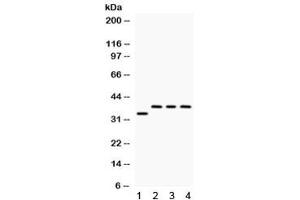Western blot testing of 1) rat brain, 2) human SW620, 3) human 22RV1 and 4) human Hela lysate with DARPP-32 antibody. (DARPP32 antibody)