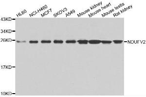Western blot analysis of extracts of various cell lines, using NDUFV2 antibody. (NDUFV2 antibody)