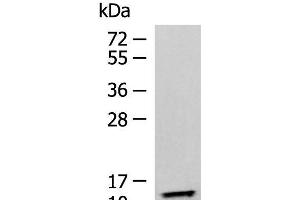Western blot analysis of Human fetal liver tissue lysate using TMEM141 Polyclonal Antibody at dilution of 1:900 (TMEM141 antibody)