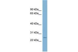 Image no. 1 for anti-CD160 (CD160) (AA 107-156) antibody (ABIN6743097) (CD160 antibody  (AA 107-156))