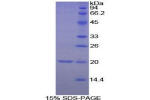 SDS-PAGE analysis of Mouse Matrix Gla Protein. (MGP Protein)