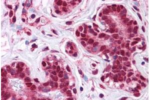 Human Breast: Formalin-Fixed, Paraffin-Embedded (FFPE) (LMBRD1 antibody  (C-Term))