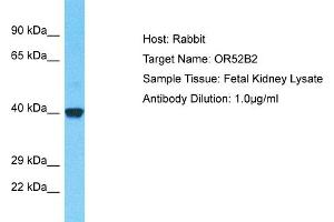 Host: Rabbit Target Name: OR52B2 Sample Type: Fetal Kidney lysates Antibody Dilution: 1.