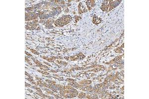 IHC analysis of TXNDC5 using anti-TXNDC5 antibody (ABIN7599699). (TXNDC5 antibody  (AA 109-403))