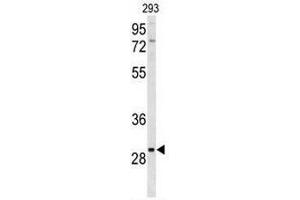 Western blot analysis of CLRN3 Antibody (C-term) in 293 cell line lysates (35µg/lane). (Clarin 3 antibody  (C-Term))