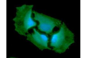 ICC/IF analysis of GPI in HeLa cells line, stained with DAPI (Blue) for nucleus staining and monoclonal anti-human GPI antibody (1:100) with goat anti-mouse IgG-Alexa fluor 488 conjugate (Green). (GPI antibody  (AA 1-558))